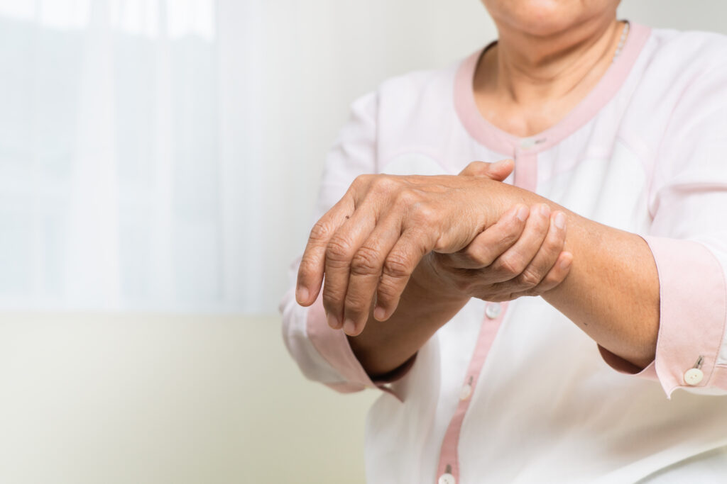 psoriatic arthritis hand in a women